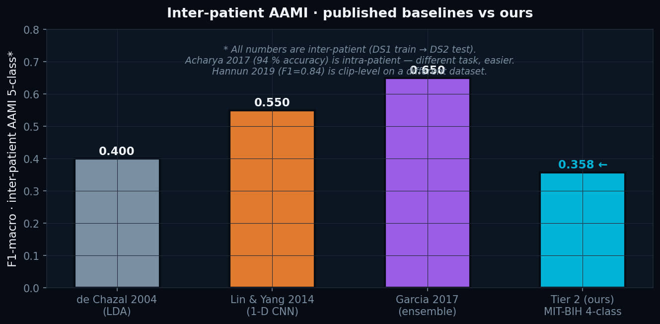 Inter-patient AAMI vs literature